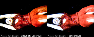 Illustration for article titled Mitsubishi LaserVue vs. Pioneer Kuro Plasma: The High-End Throwdown